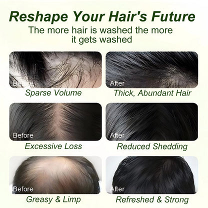 Tgideas® Batana Oil & Rosemary Volumizing Shampoo
