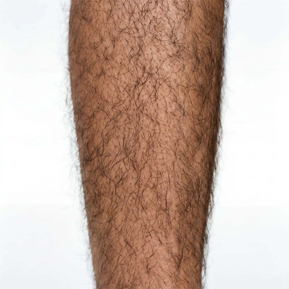 After — smooth silky leg, hair-free result close-up
